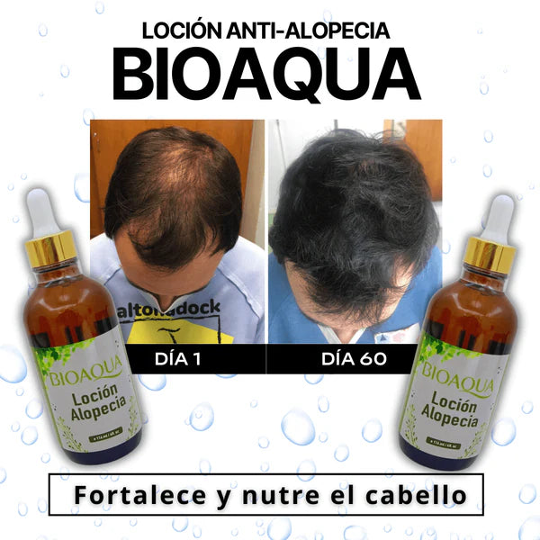 TONICO CAPILAR BIOAQUA – FUERZA Y CRECIMIENTO NATURAL PARA TU CABELLO 🌿✨